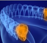 סיאלאנדוסקופיה - תמונת המחשה